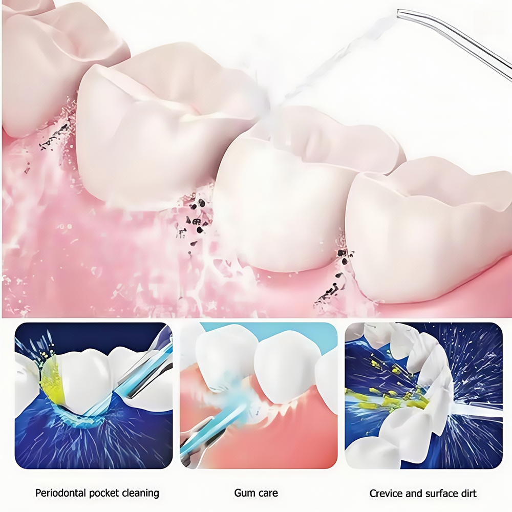 Portable High-Pressure Oral Ir - Oral Irrigator Flosser review and price
