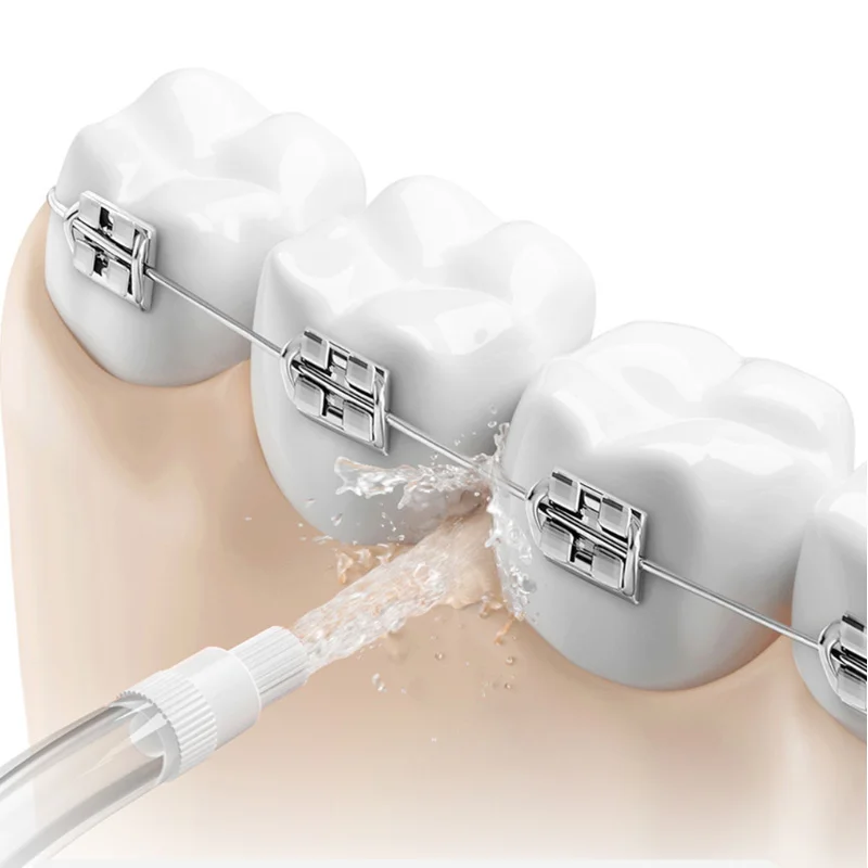 Original Nozzles for all Xiaom - Oral Irrigator Flosser review and price
